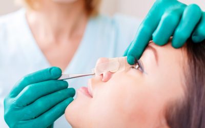 مراقبت های بعد از عمل بینی؛ 0 تا 100 نکات