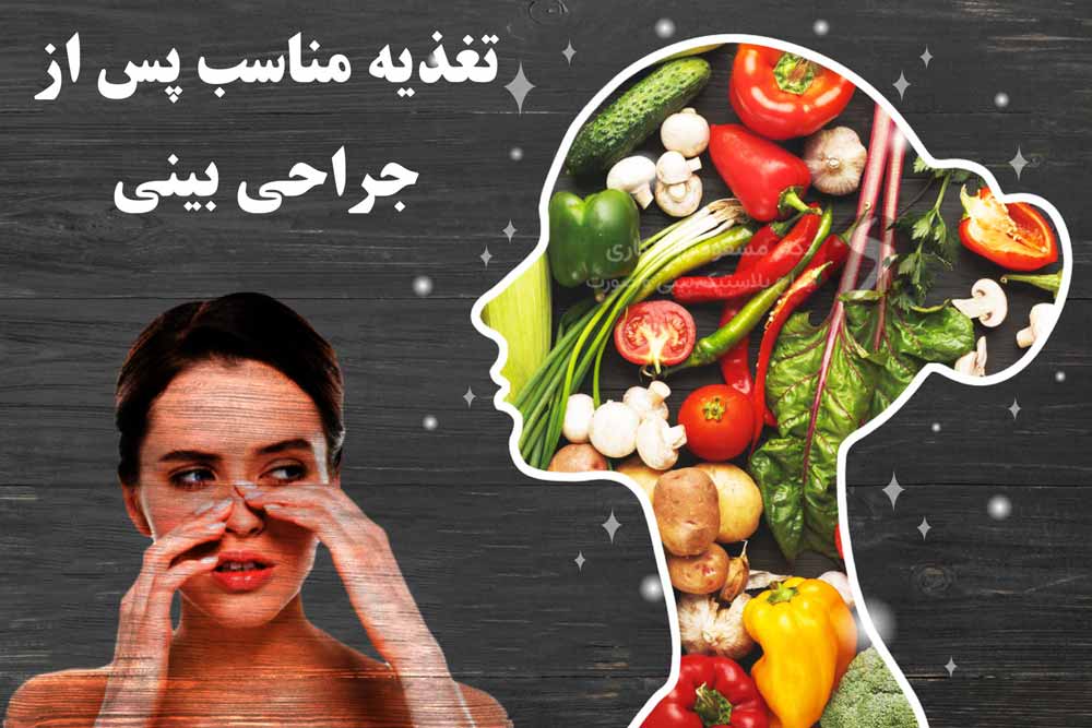 برنامه غذایی پس از جراحی بینی