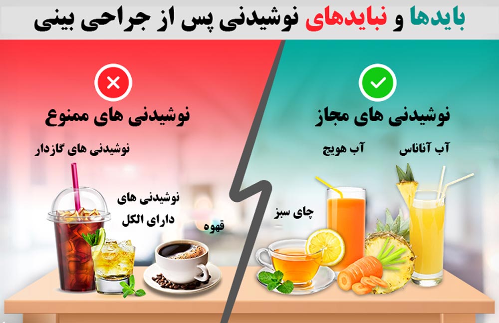 نوشیدنی های مجاز و ممنوع پس از عمل بینی