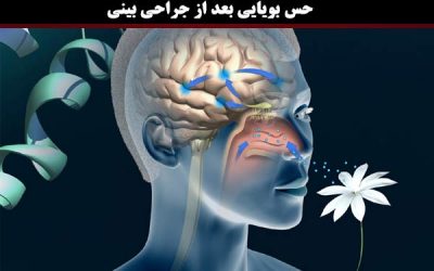 حس بویایی قبل و بعد از جراحی بینی؛ نفهمیدن بو بعد از جراحی بینی