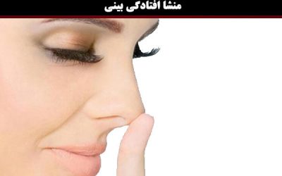 چه عواملی موجب افتادگی بینی می شود؟