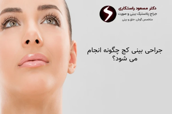 نحوه انجام عمل بینی کج