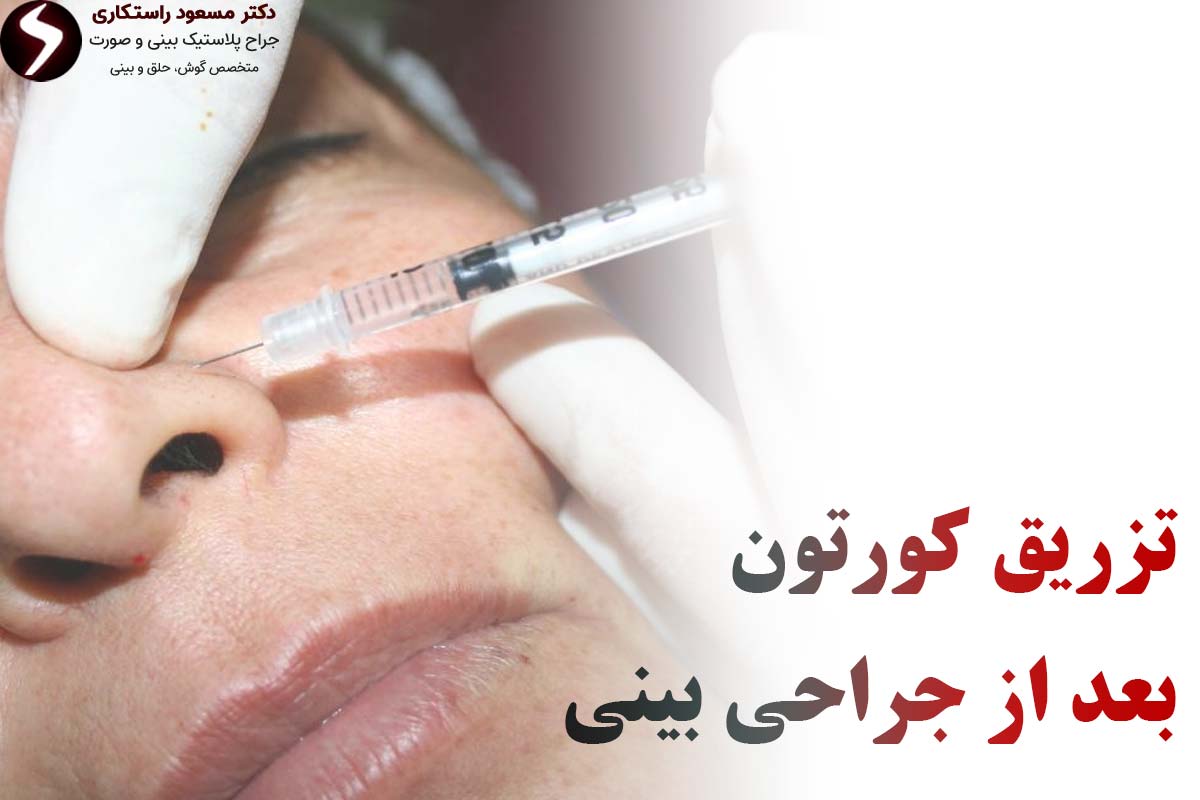تزریق کورتون به بینی تزریق کورتون به بینی