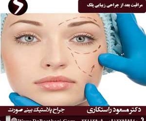 مراقبت های بعد از جراحی پلک؛ باید ها و نباید های بعد از بلفاروپلاستی