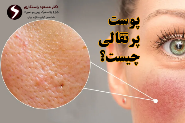 منفذ های پوست بینی