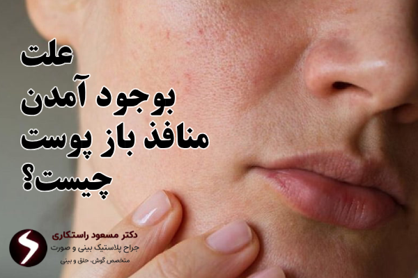 به وجود امدن منافذ باز پوست