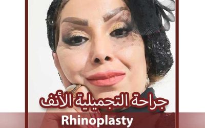 جراحه الانف اللحمی