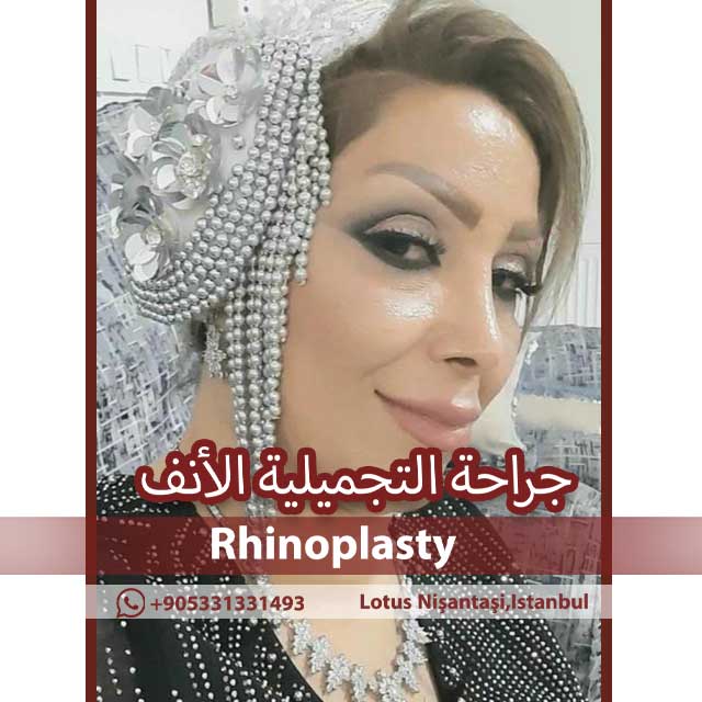 جراحه التجمیلیه الانف