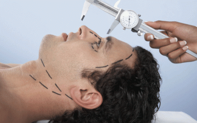 جراحة الانف العظمی