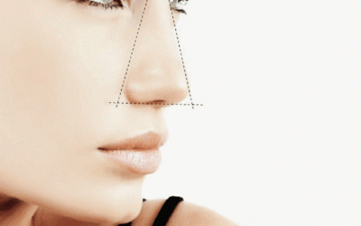 عنایات بعد عملیه التجمیلیه للانف