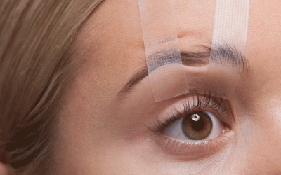 جراحه الجفن