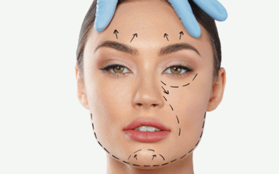 تجديد شباب الوجه