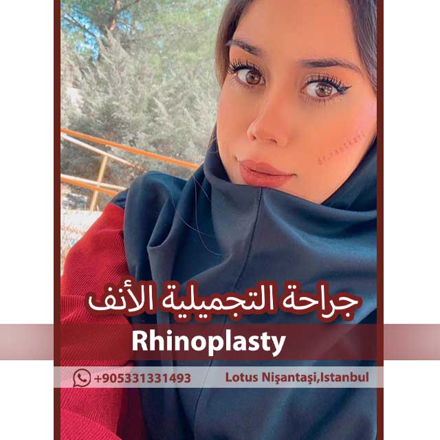 نتيجة لعملية تجميل الأنف