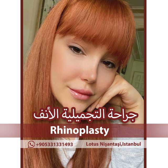 جراحة انحراف الحاجز الأنفي