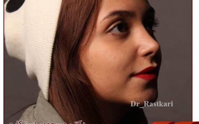 7 روش برای کاهش ورم بینی بعد عمل + رفع کبودی پس از جراحی