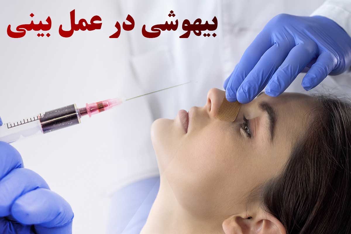 بیهوشی در جراحی بینی بیهوشی در جراحی بینی