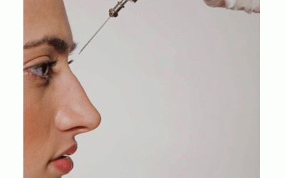 جراحة الأنف بالمخدر الموضعي