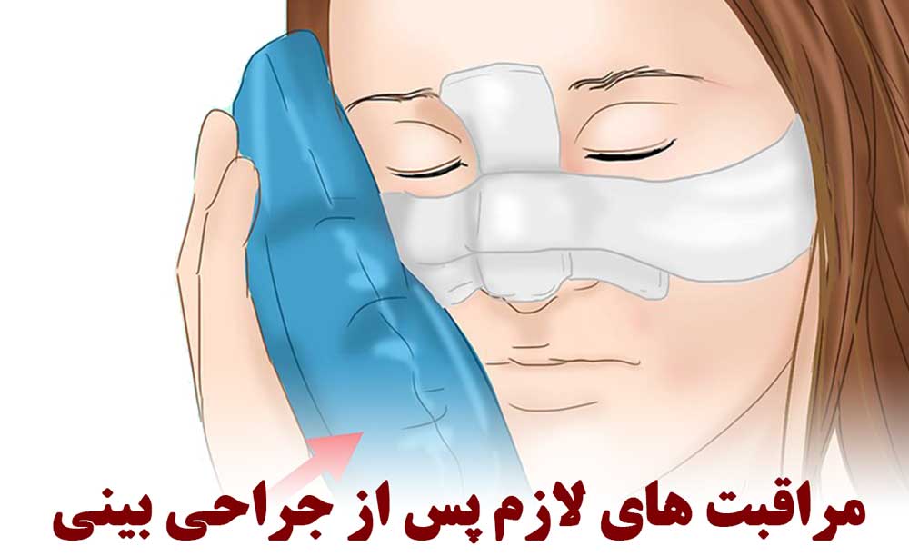 کمپرس آب سرد