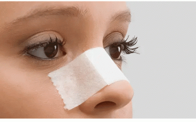 مضاعفات جراحة الأنف