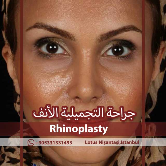 أفضل جراح الأنف الطبيعية