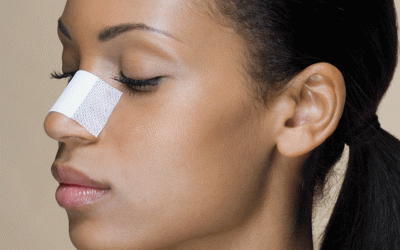 أفضل جراح الأنف الطبيعية