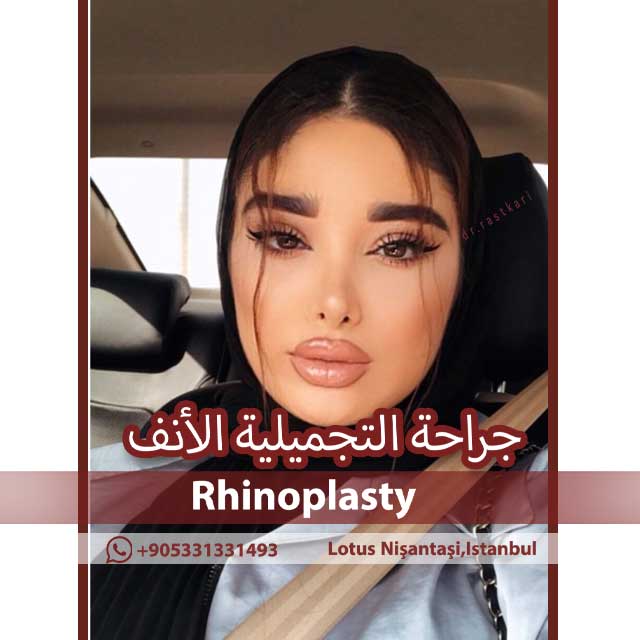 جراحه الجفن العلیا