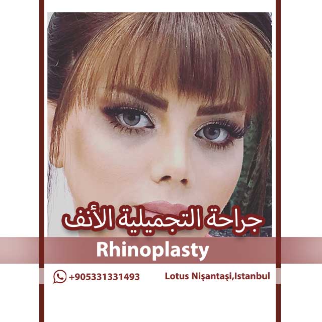 رعاية ما بعد جراحة رأب الجفن