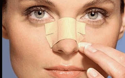 أسئلة الشائعه حول جراحة الأنف