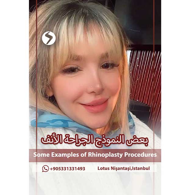 شد الجلد الوجه