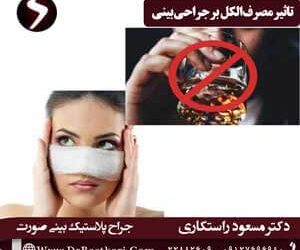 تاثیر مصرف الکل بر جراحی بینی؛ عوارض مشروب قبل و بعد عمل