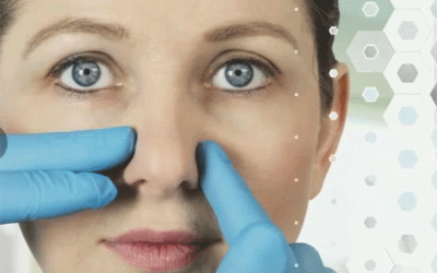 جراحة الأنف عند المراهقين