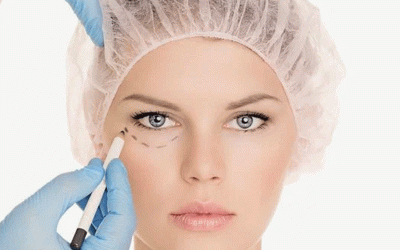 جراحه تدلی الجفن