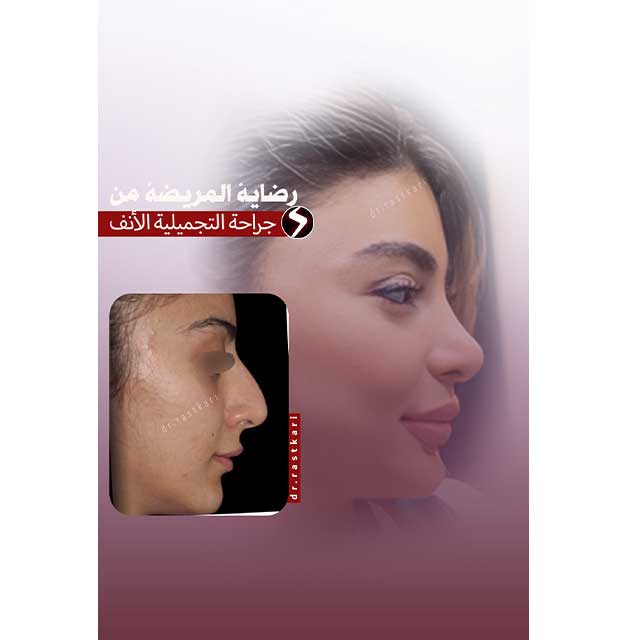  الرعایه بعد حقن الجل             