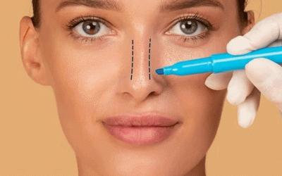 هل جراحة الأنف ممكنة مع فيروس كورونا؟