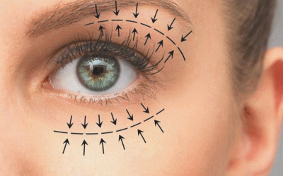 افضل جراح راب الجفن فی طهران