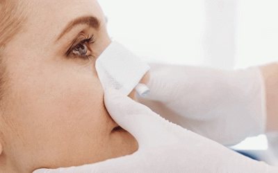 تنظير الجيوب الأنفية من الانف