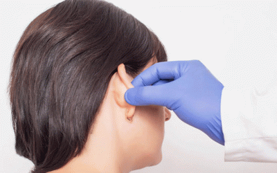 جراحة الأذن (رأب الاذن)