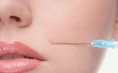 حقن الدهون طريقة آمنة للتجديد