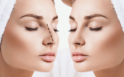 التغذية السليمة بعد عملية التجميلیة الأنف