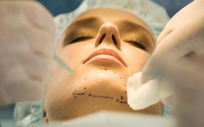 پروتز چانه و تغییر باورنکردنی چهره