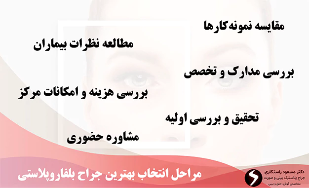 مراحل انتخاب بهترین جراح بلفاروپلاستی مراحل انتخاب بهترین جراح بلفاروپلاستی