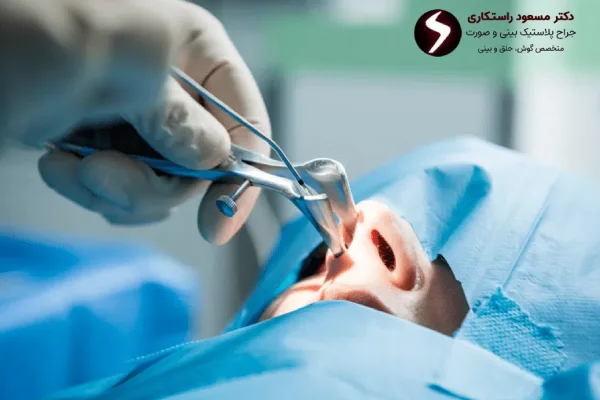 مراحل آندوسکوپی سینوس