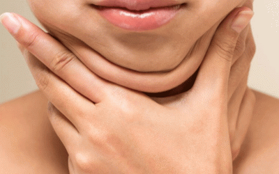 لیپوماتیک غبغب: هر آنچه باید بدانید