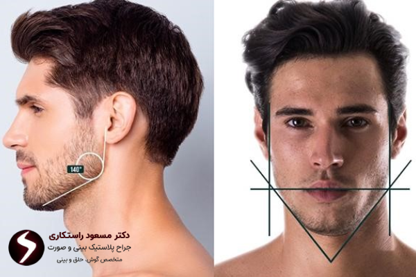 مزایای زاویه سازی صورت مردان