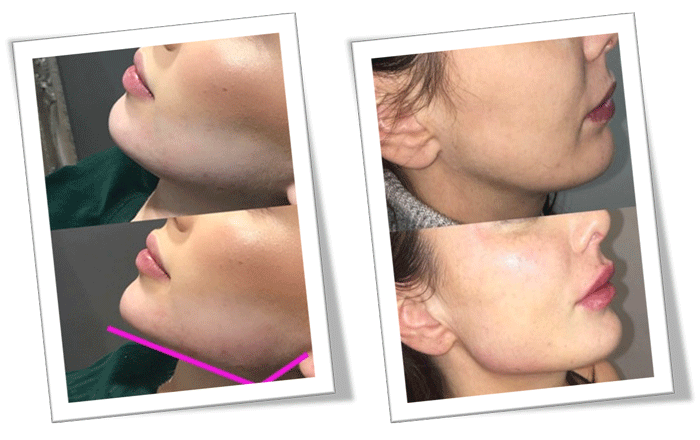 زاویه دار کردن صورت