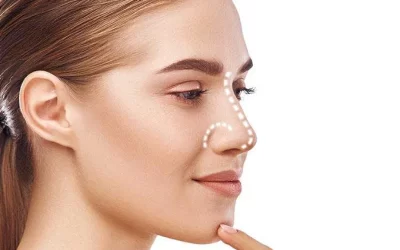 بهترین جراح بینی طبیعی در تهران + عکس قبل و بعد نمونهکارها