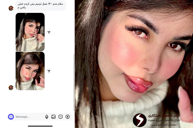 رضایت از دکتر مسعود راستکاری بهترین جراح بینی ترمیمی