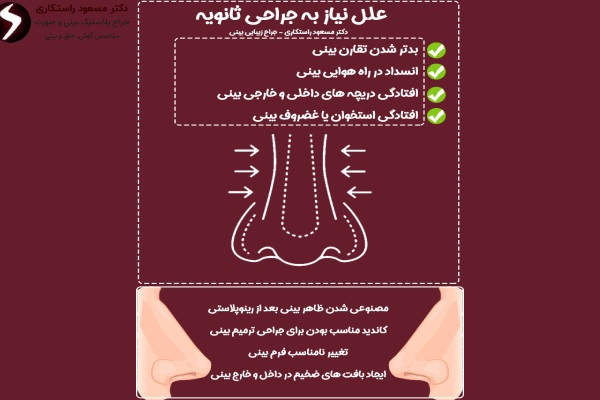 علل نیاز به جراحی ترمیمی بینی علل نیاز به جراحی ترمیمی بینی