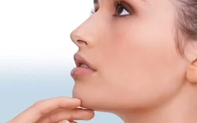 عمل بینی استخوانی؛ عکس قبل و بعد + بهترین مدل جراحی