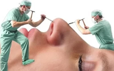 عمل بینی برای چه کسانی خطرناک است؟ 